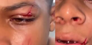 Aluno de 11 anos é agredido por colegas em escola de Camaçari